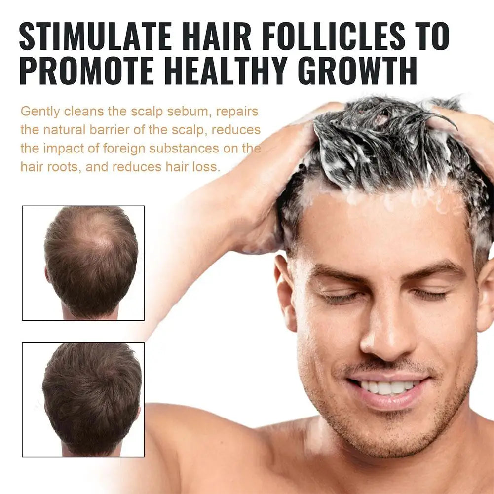 Hair Loss Treatment Shampoo Promotes Growth, Strengthens Roots, Repairs Scalp, Anti-Thinning & Moisturizing Thickening Hair Care